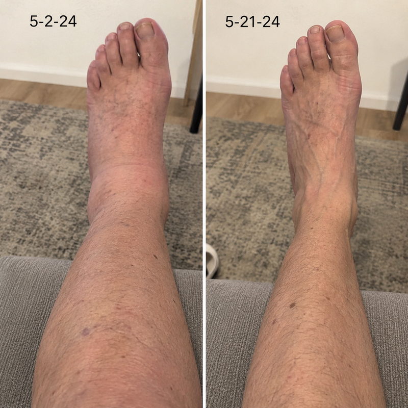 using Curvevera less than 8 weeks