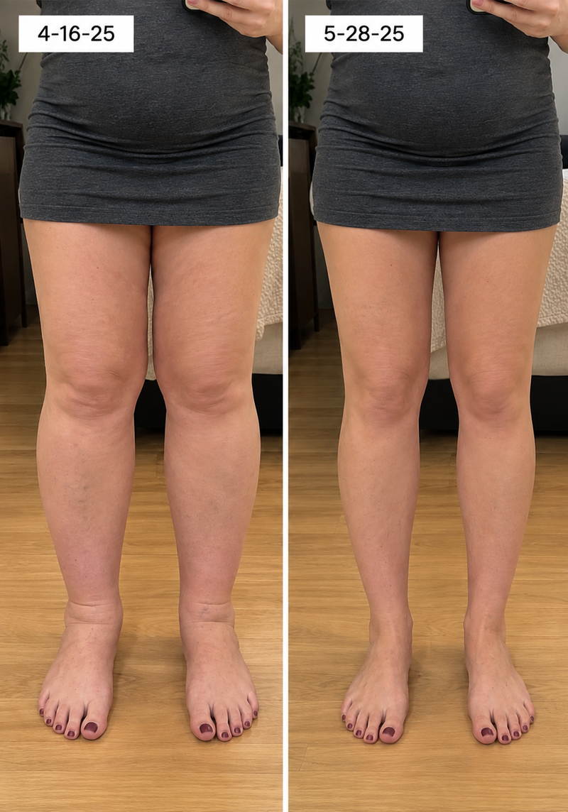 using Curvevera less than 8 weeks