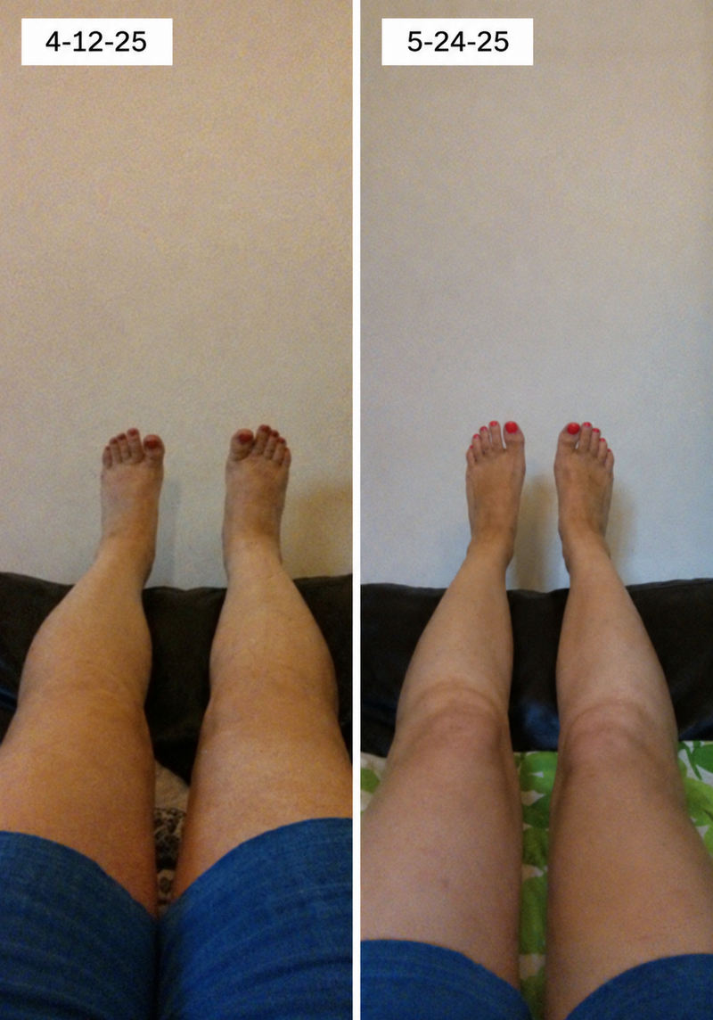 using Curvevera less than 8 weeks