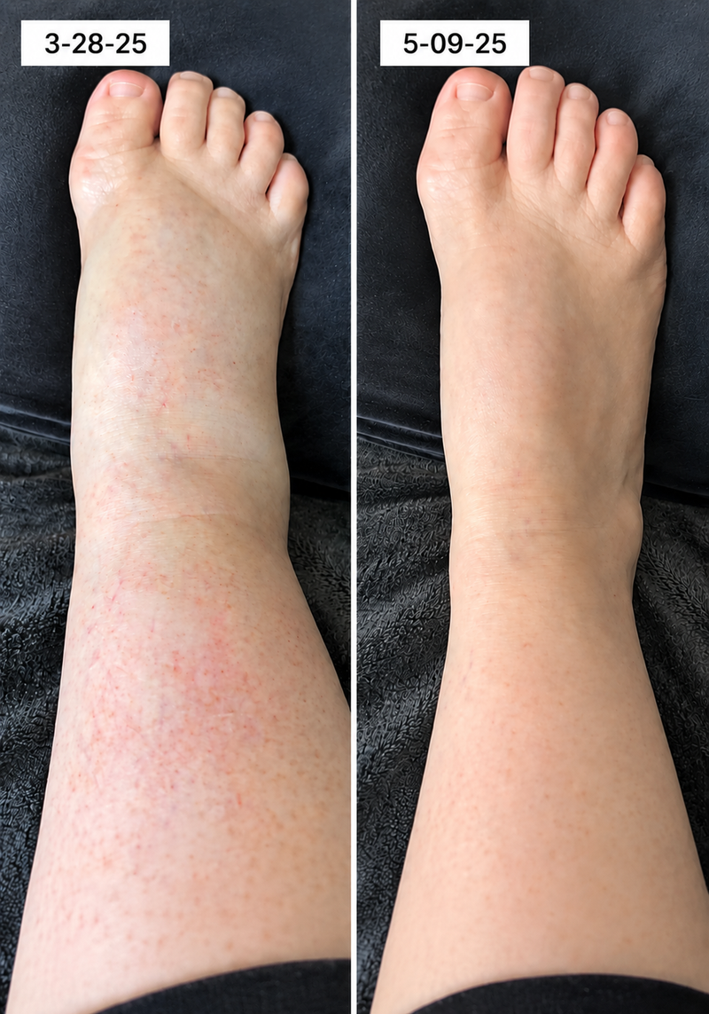 using Curvevera less than 8 weeks